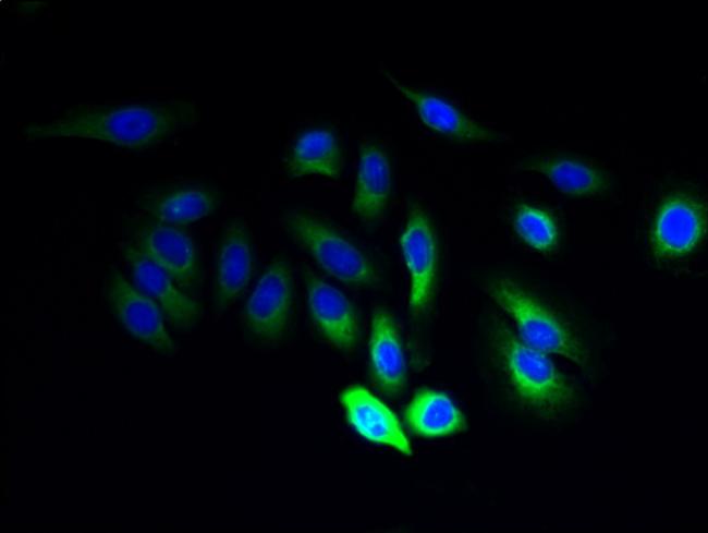 JAGN1 Antibody in Immunocytochemistry (ICC/IF)