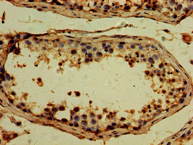 TTLL6 Antibody in Immunohistochemistry (Paraffin) (IHC (P))