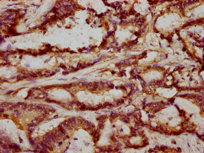 FRMD6 Antibody in Immunohistochemistry (Paraffin) (IHC (P))