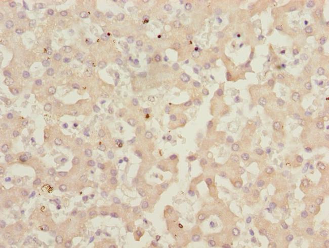 IWS1 Antibody in Immunohistochemistry (Paraffin) (IHC (P))