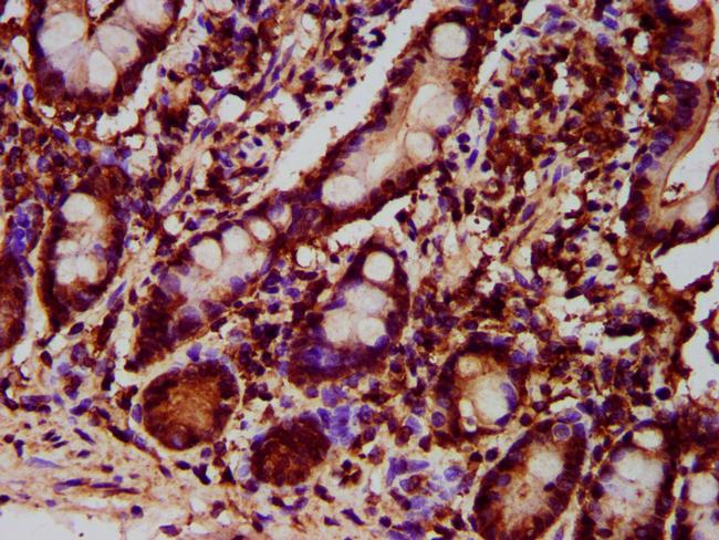 GPT2 Antibody in Immunohistochemistry (Paraffin) (IHC (P))