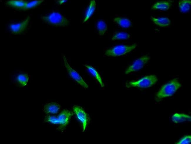 SLC22A17 Antibody in Immunocytochemistry (ICC/IF)