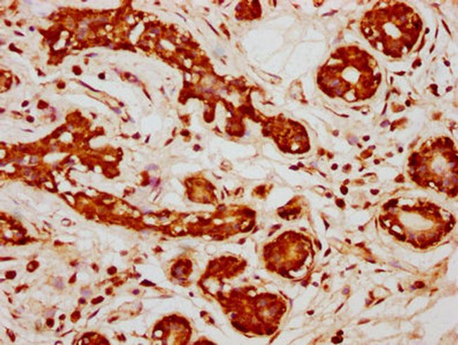 PPP2R1B Antibody in Immunohistochemistry (Paraffin) (IHC (P))