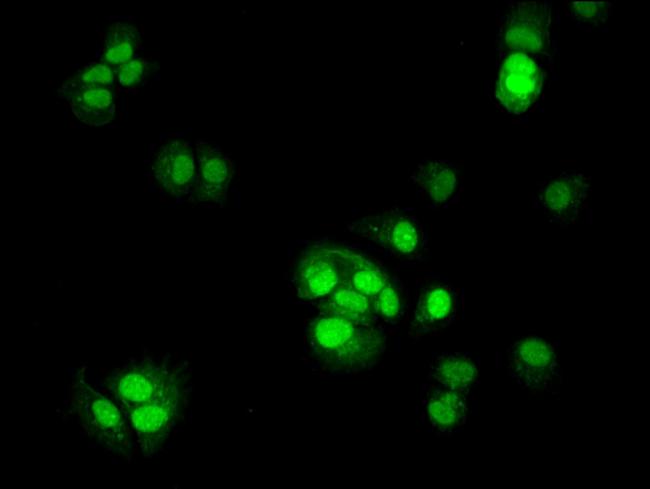 TSR2 Antibody in Immunocytochemistry (ICC/IF)