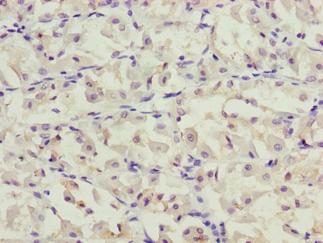 PPP2R3C Antibody in Immunohistochemistry (Paraffin) (IHC (P))