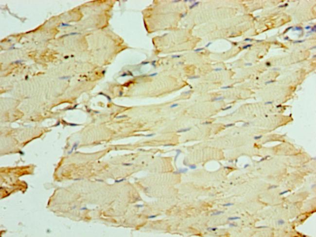 ATGL Antibody in Immunohistochemistry (Paraffin) (IHC (P))