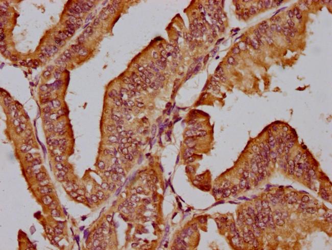 Jouberin Antibody in Immunohistochemistry (Paraffin) (IHC (P))