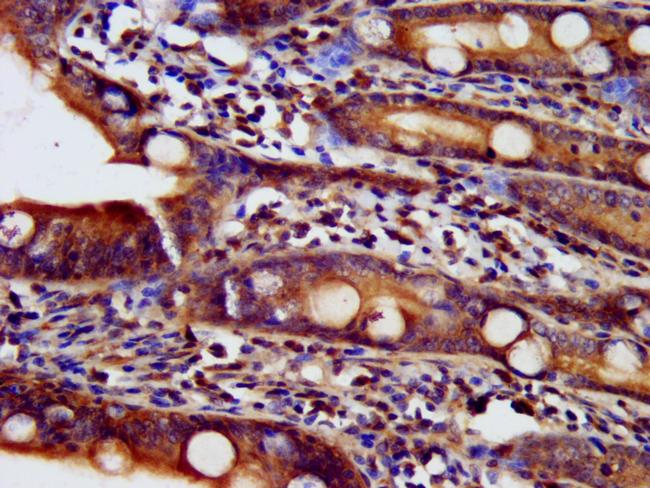 NDUFAF2 Antibody in Immunohistochemistry (Paraffin) (IHC (P))