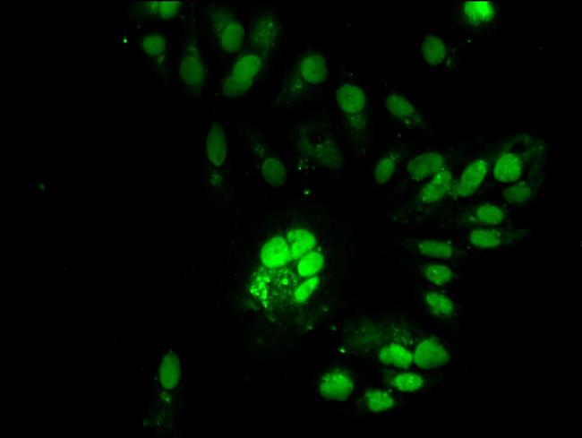 RNaseH2C Antibody in Immunocytochemistry (ICC/IF)