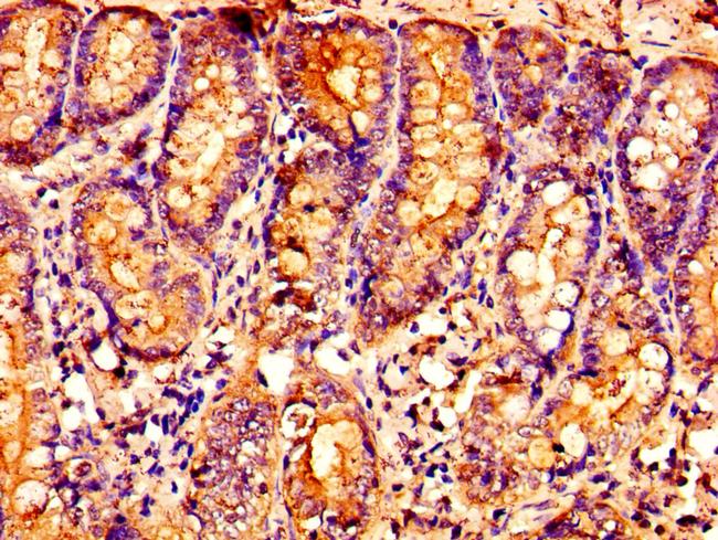 OXER1 Antibody in Immunohistochemistry (Paraffin) (IHC (P))