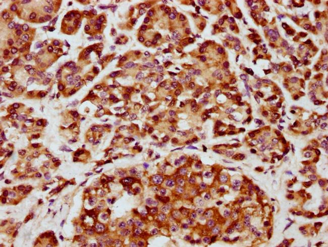 CHST14 Antibody in Immunohistochemistry (Paraffin) (IHC (P))