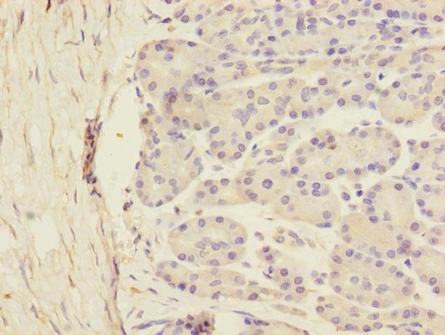 SCFD1 Antibody in Immunohistochemistry (Paraffin) (IHC (P))