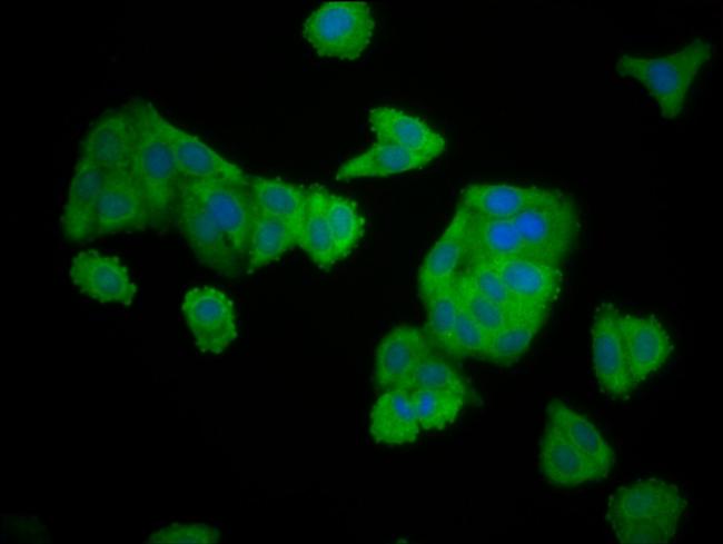 ELMOD3 Antibody in Immunocytochemistry (ICC/IF)