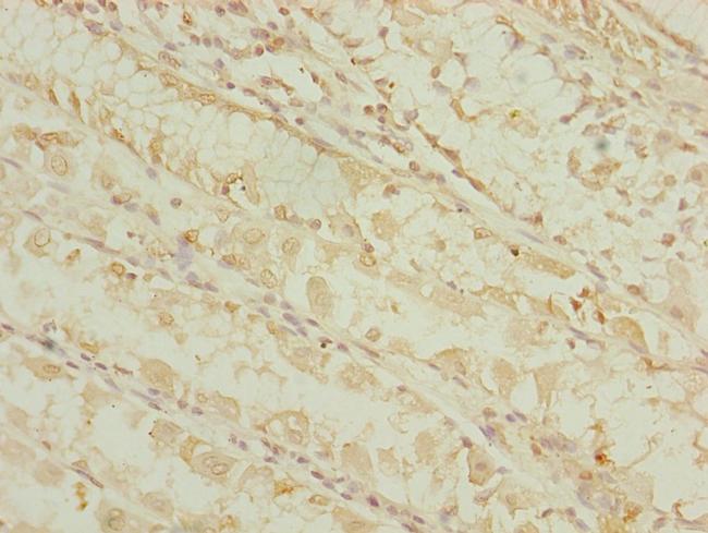 DHTKD1 Antibody in Immunohistochemistry (Paraffin) (IHC (P))