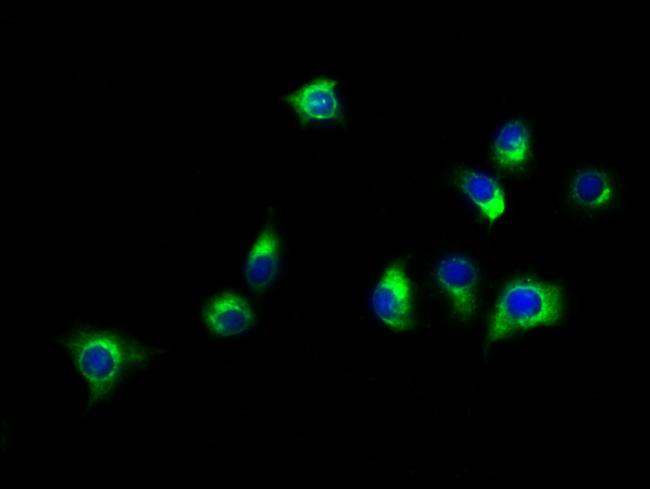 SLC16A11 Antibody in Immunocytochemistry (ICC/IF)