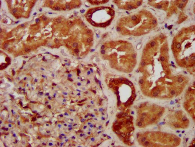 SUCLG2 Antibody in Immunohistochemistry (Paraffin) (IHC (P))