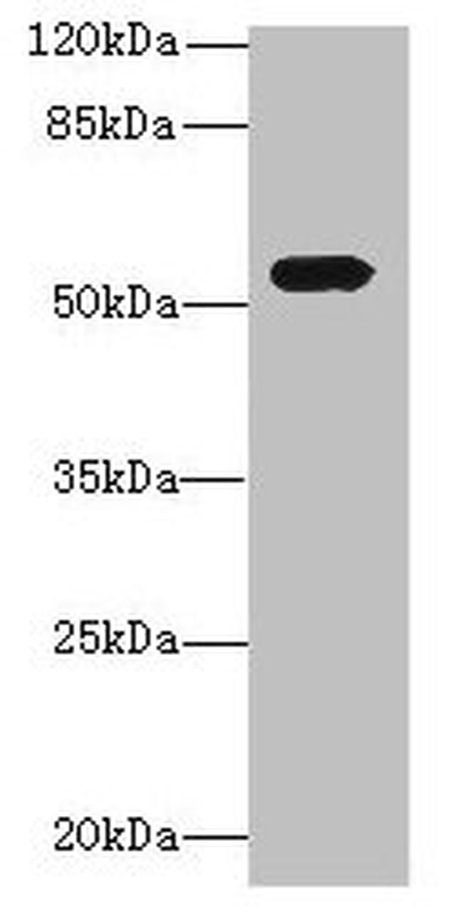 ICA1L Antibody in Western Blot (WB)