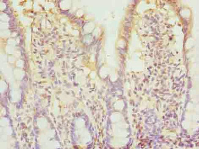 BTN2A2 Antibody in Immunohistochemistry (Paraffin) (IHC (P))