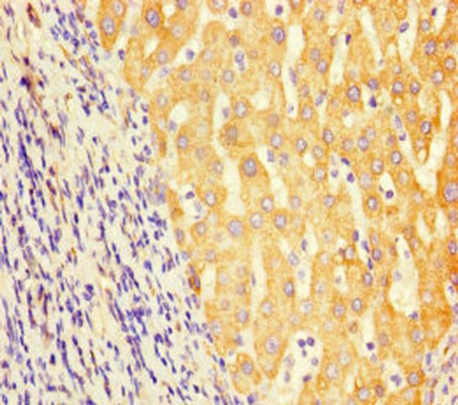 GCDH Antibody in Immunohistochemistry (Paraffin) (IHC (P))