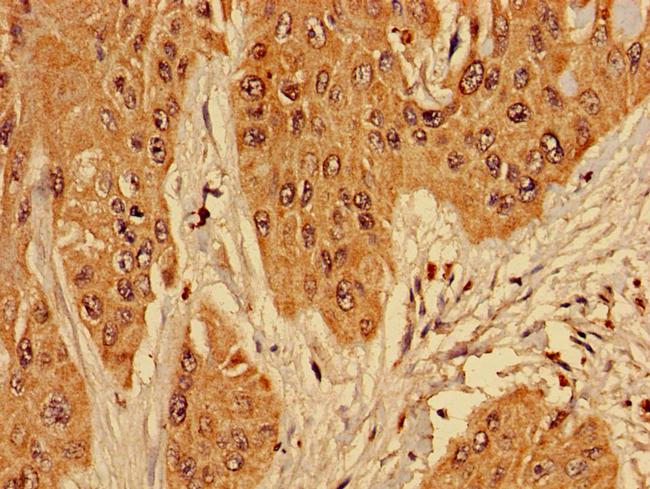 RPL10L Antibody in Immunohistochemistry (Paraffin) (IHC (P))