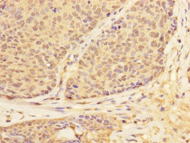 USP28 Antibody in Immunohistochemistry (Paraffin) (IHC (P))