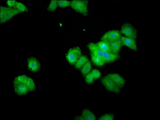 Themis Antibody in Immunocytochemistry (ICC/IF)