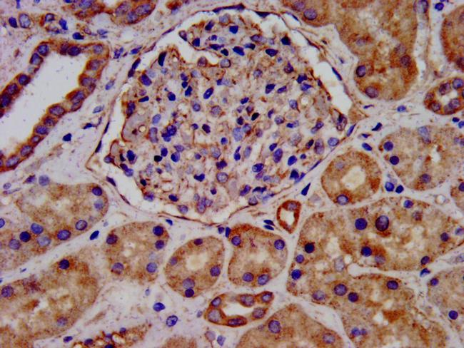 LEMD2 Antibody in Immunohistochemistry (Paraffin) (IHC (P))