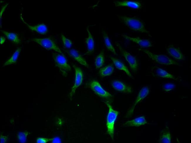 SLC25A46 Antibody in Immunocytochemistry (ICC/IF)