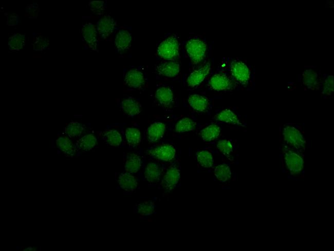 FEV Antibody in Immunocytochemistry (ICC/IF)