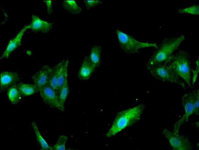 PAIP2 Antibody in Immunocytochemistry (ICC/IF)