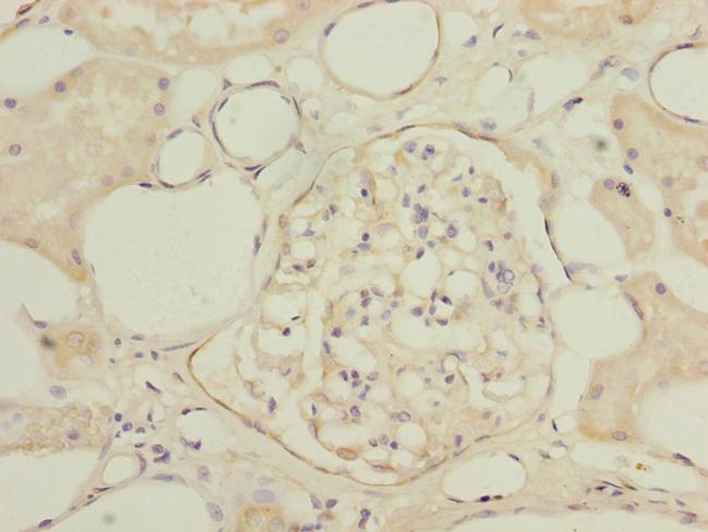 NAPG Antibody in Immunohistochemistry (Paraffin) (IHC (P))