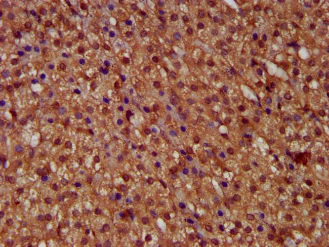 MICU1 Antibody in Immunohistochemistry (Paraffin) (IHC (P))