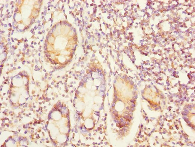 EYA3 Antibody in Immunohistochemistry (Paraffin) (IHC (P))