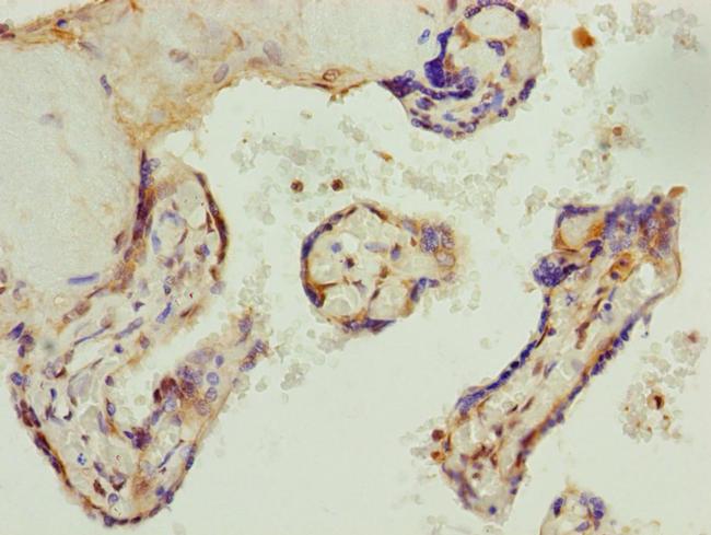 AP1M1 Antibody in Immunohistochemistry (Paraffin) (IHC (P))