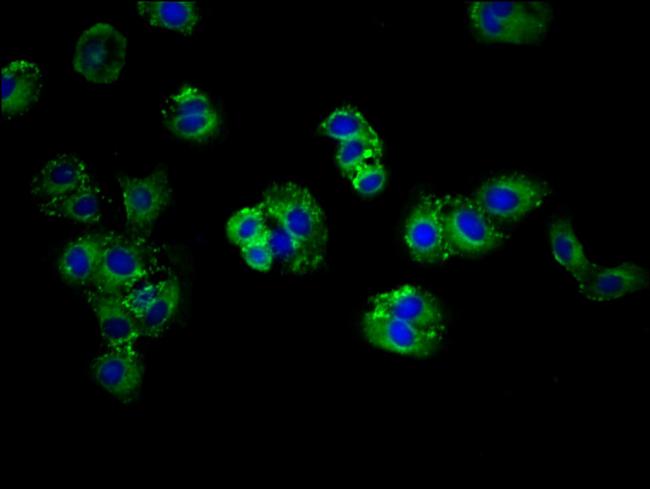 ABCG5 Antibody in Immunocytochemistry (ICC/IF)