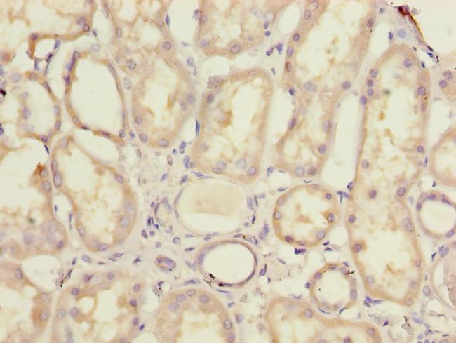 MRPL44 Antibody in Immunohistochemistry (Paraffin) (IHC (P))