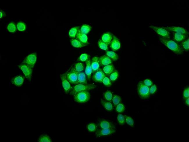 SHARPIN Antibody in Immunocytochemistry (ICC/IF)