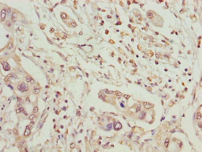 MCCC2 Antibody in Immunohistochemistry (Paraffin) (IHC (P))