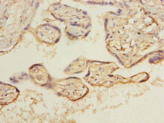 ARL8B Antibody in Immunohistochemistry (Paraffin) (IHC (P))