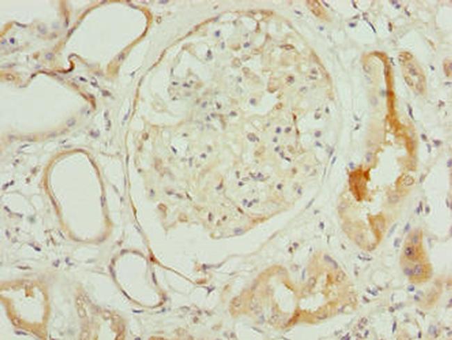 NOLA3 Antibody in Immunohistochemistry (Paraffin) (IHC (P))