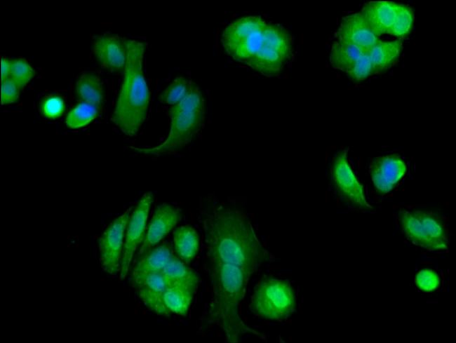 eIF4ENIF1 Antibody in Immunocytochemistry (ICC/IF)