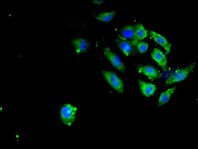 SAV1 Antibody in Immunocytochemistry (ICC/IF)