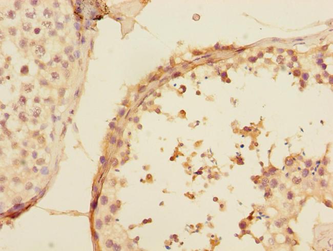 UBE2Z Antibody in Immunohistochemistry (Paraffin) (IHC (P))