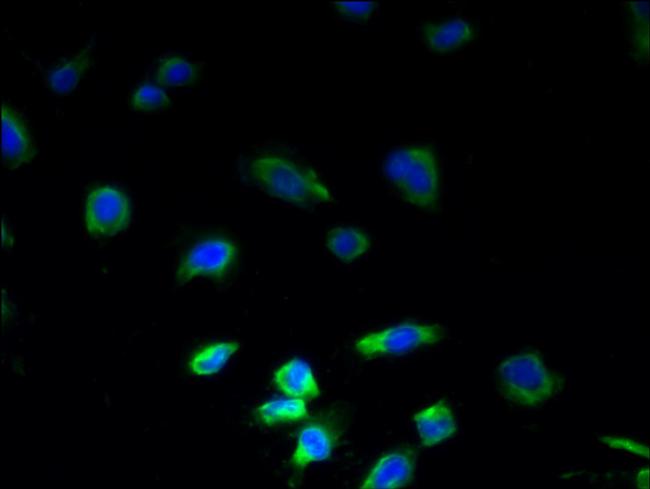 PLGRKT Antibody in Immunocytochemistry (ICC/IF)