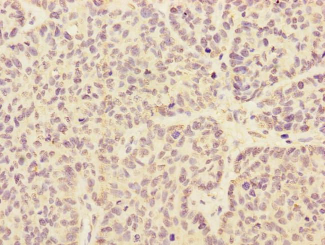 ARHGEF3 Antibody in Immunohistochemistry (Paraffin) (IHC (P))