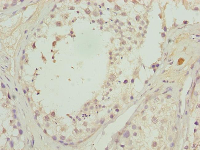 CALCOCO1 Antibody in Immunohistochemistry (Paraffin) (IHC (P))