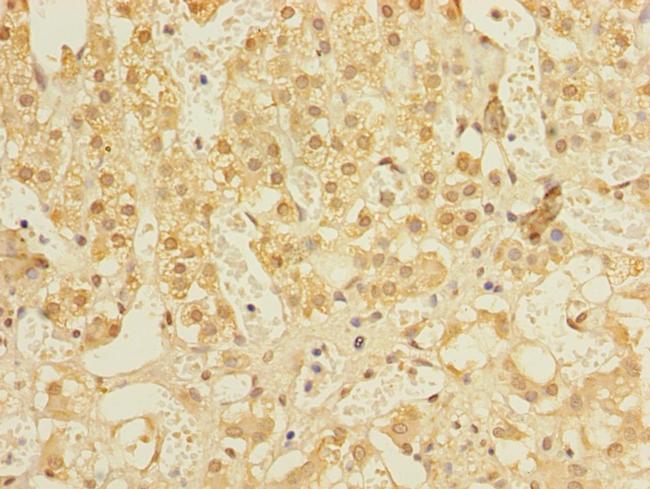 ALS2CR1 Antibody in Immunohistochemistry (Paraffin) (IHC (P))