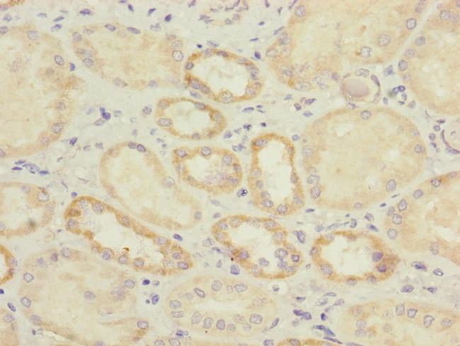 IL17RB Antibody in Immunohistochemistry (Paraffin) (IHC (P))