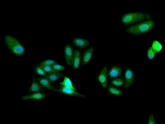 FARSB Antibody in Immunocytochemistry (ICC/IF)