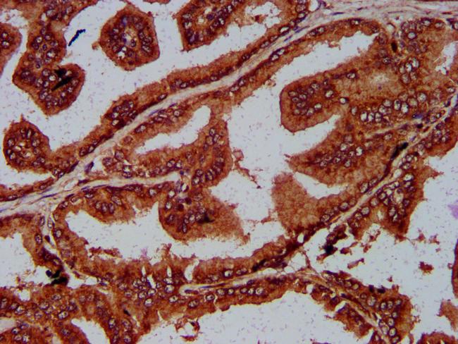 UNC84B Antibody in Immunohistochemistry (Paraffin) (IHC (P))